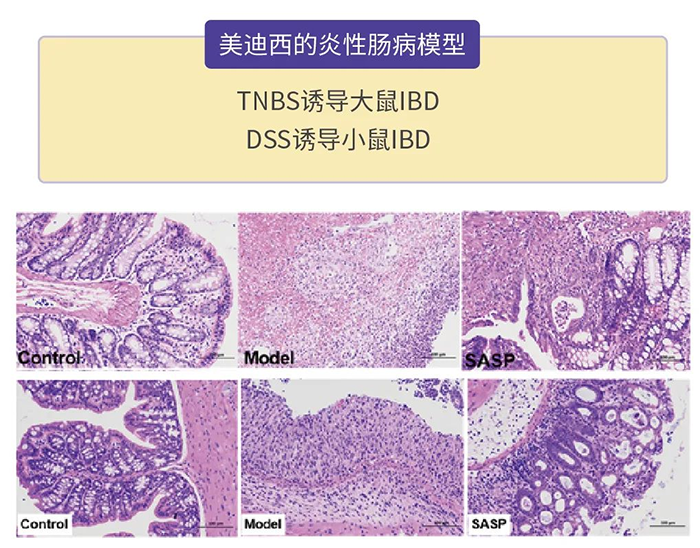 美迪西的炎性肠病模型.png 美迪西的炎性肠病模型.png